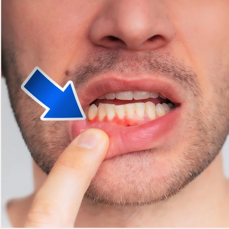 Die 10 Vitamin-C- Mangelzeichen... Hättest Du das gedacht? - ein Artikel von Annette Lartey - AlphaGenetik -  - Quelle für mehr Leistungsfähigkeit